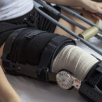Services-Joint-replmnt Image of knee splint on a person who has had a knee replacement procedure