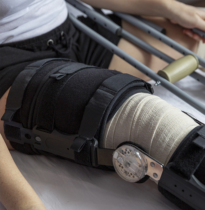 Services-Joint-replmnt Picture of knee bandaged in a splint.
