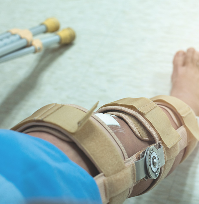 Services-Post-Surgical Picture of knee brace and crutches on a post-surgical patient.