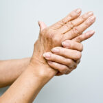Services-arthritis Picture of arthritic hand